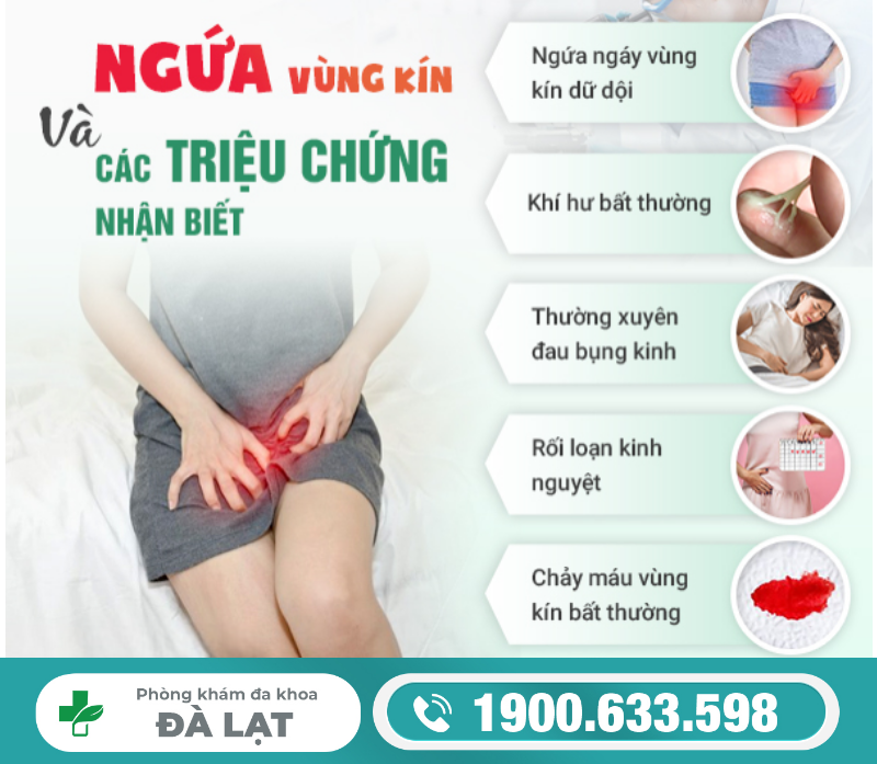 Hình ảnh minh họa